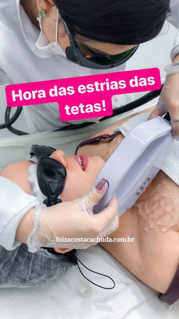 Fotorrejuvenescimento vale a pena