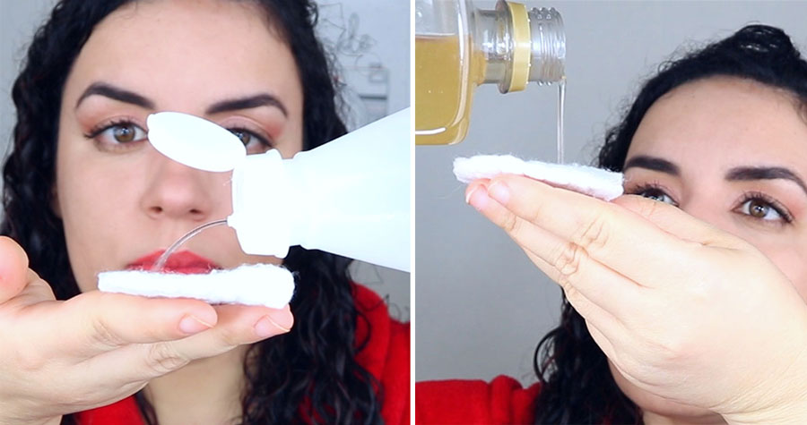 Receita caseira para pele oleosa e poros dilatados - soro + vinagre Receita caseira para pele oleosa e poros dilatados - soro + vinagre