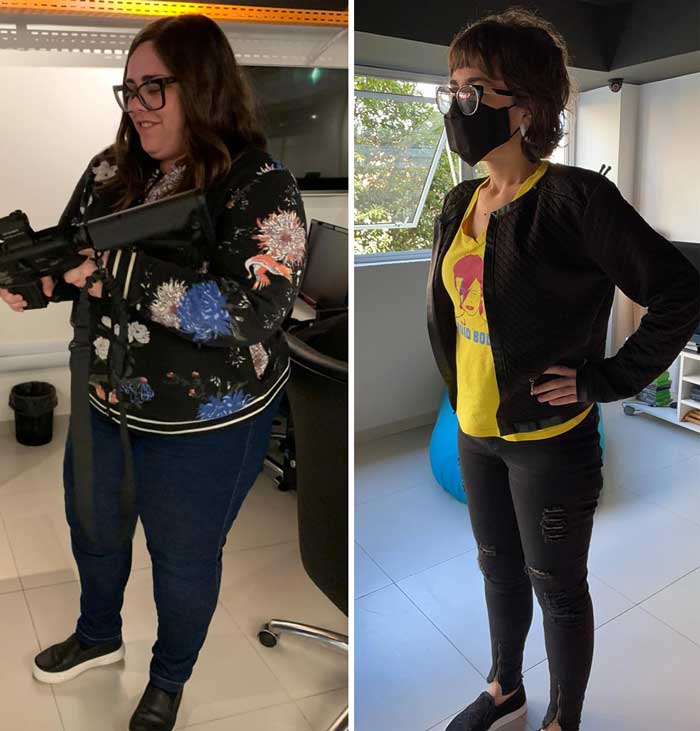 antes e depois da redução de estômago