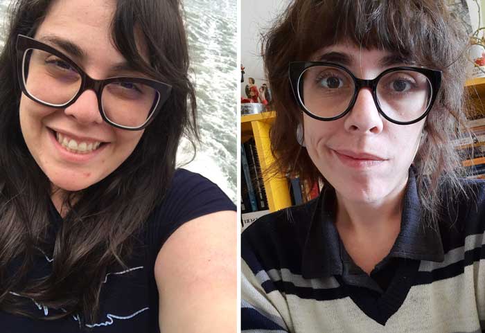 antes e depois da bariátrica