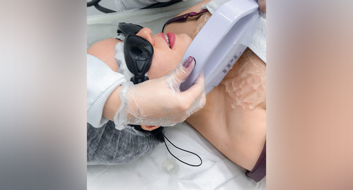 fotorrejuvenescimento é bom?