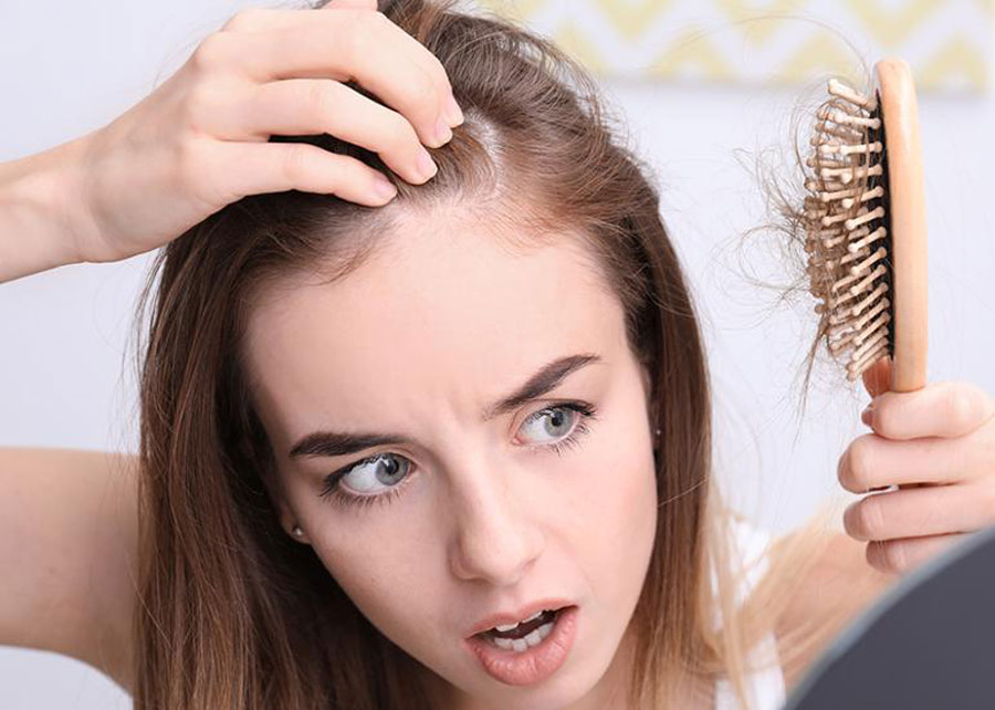 O que é Alopecia