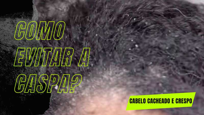 Como acabar com a caspa em cabelo cacheado