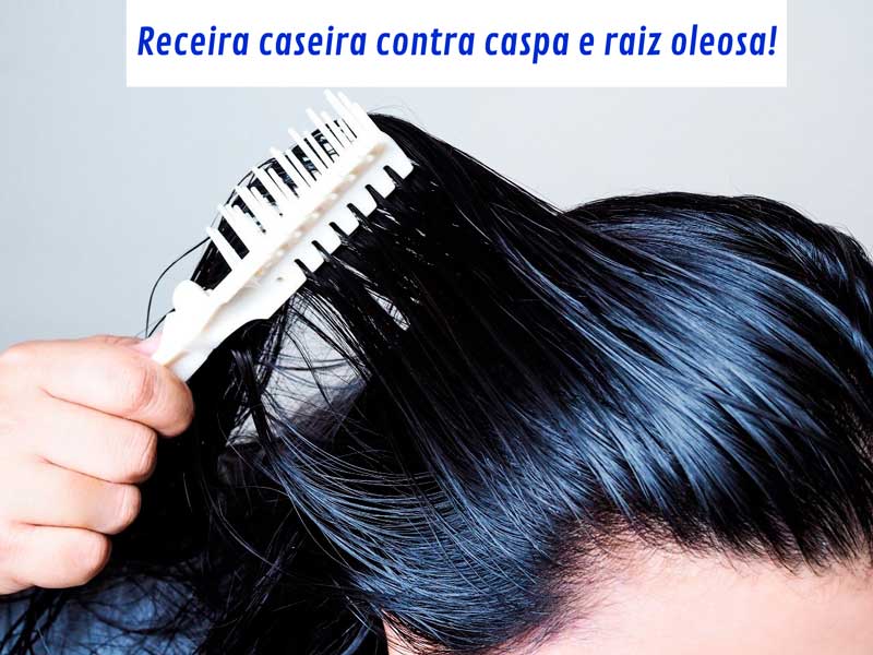 caspa e oleosidade